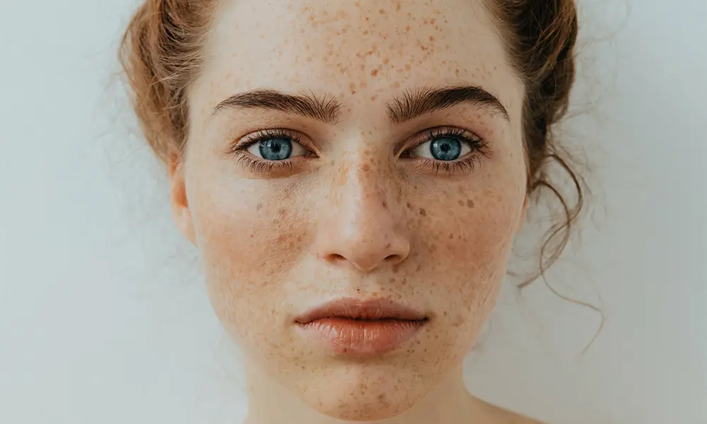 Pigmentation Treatments in Charlotte: More Than Just Serums